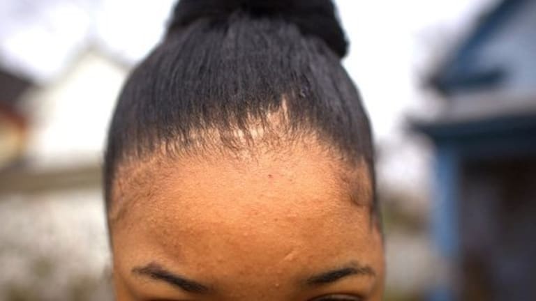 Picture of a black woman's forehead and hair.