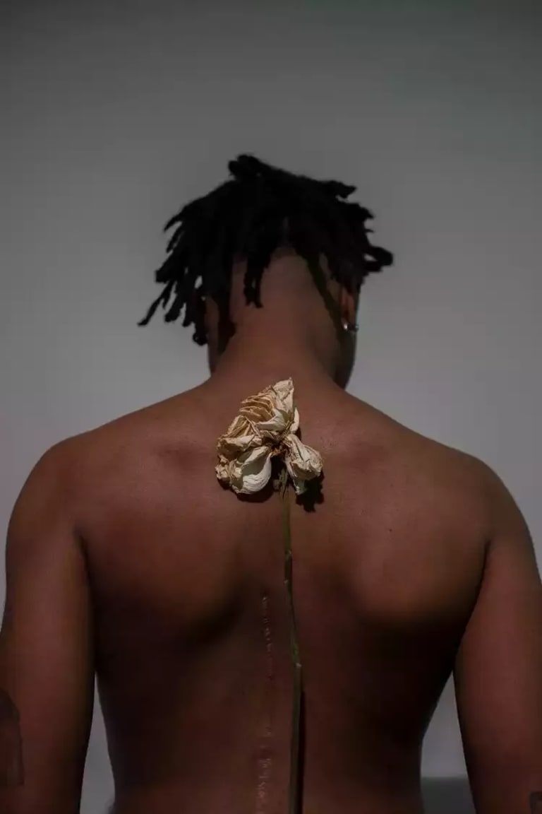  A photograph of a black person's back that has a long scar down the spine; next to the scar a flower with a long stem is also against their back.