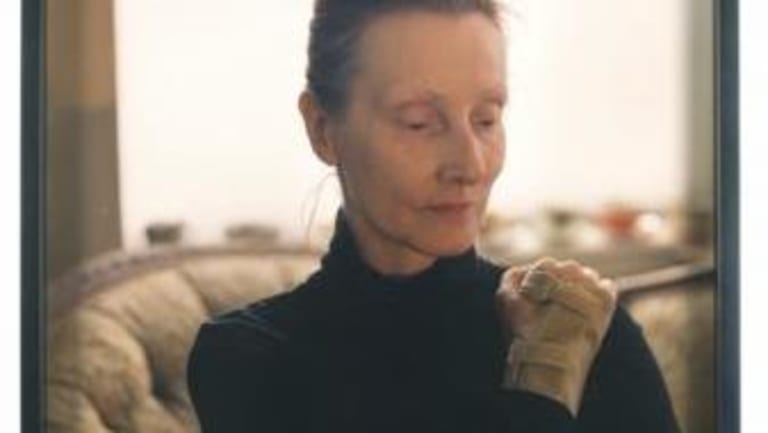 A women with a black turtleneck sits with her right arm on her shoulder.  There is a window with light coming through in the background.  Her  right hand has a cast.