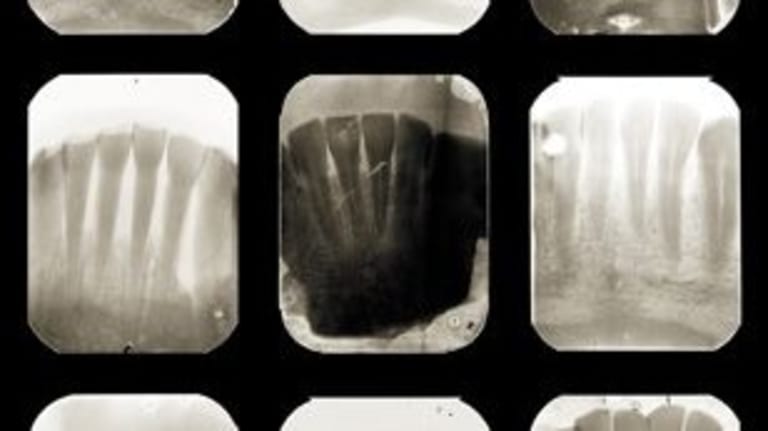 X-rays of some sort. Possibly dental or possibly toes (though there are six on each image so it would be an irregular foot).