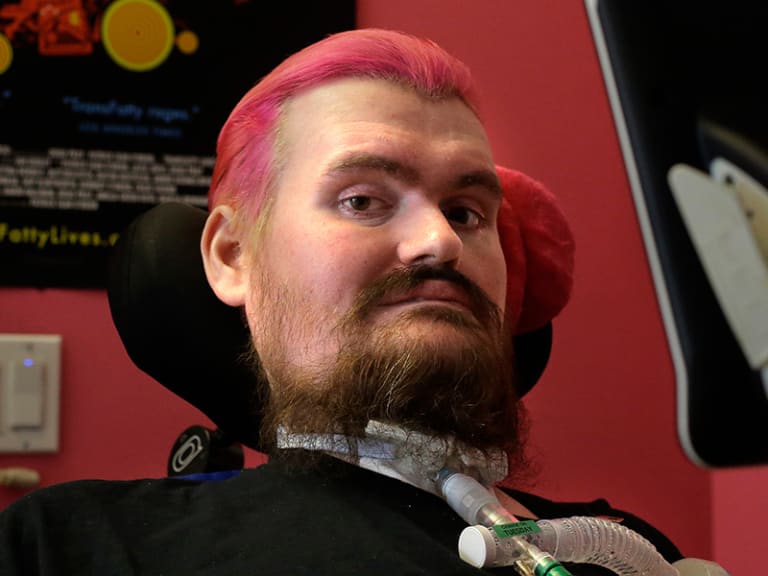 A man with pink hair and a tube connecting to his throat.