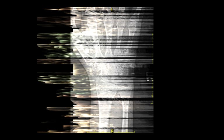 Digital art image of hand x-ray distorted through image processing
