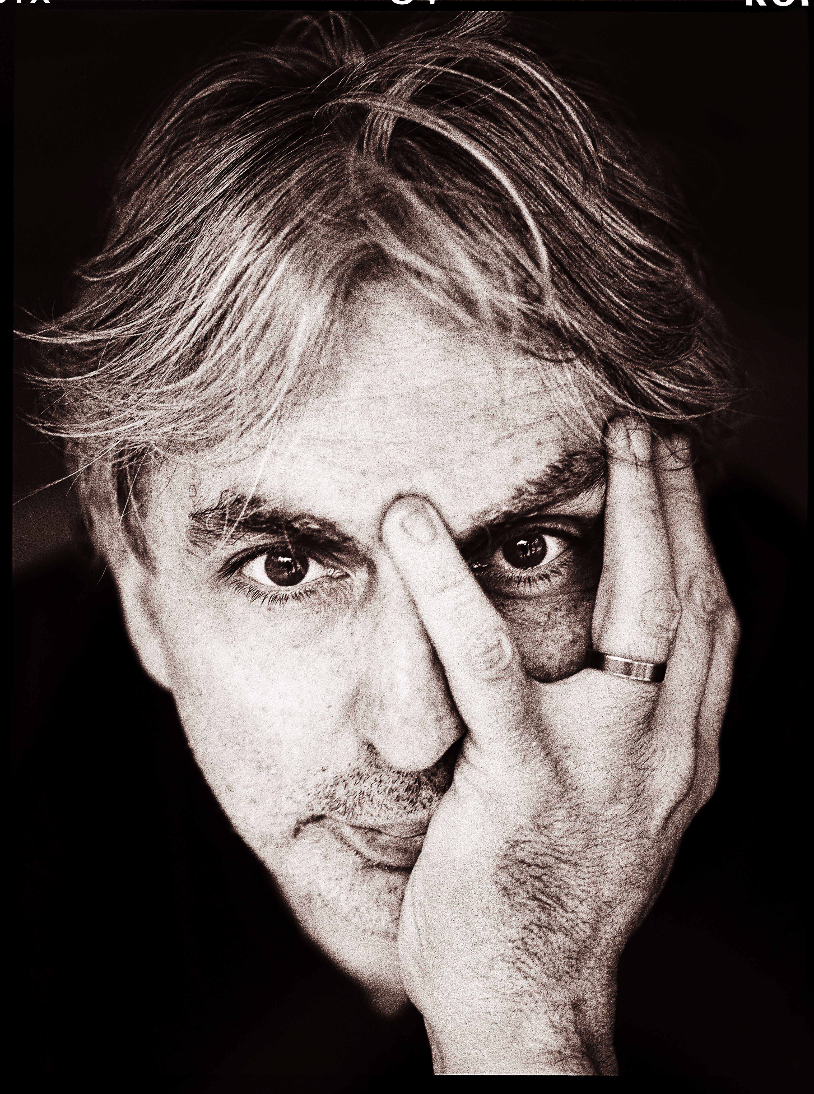 A black-and-white photograph of a man holding his head in his left hand and staring at the camera.